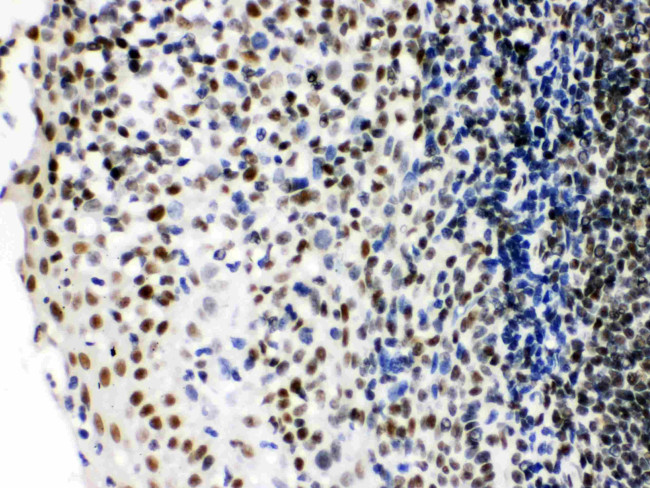 Ku70 Antibody in Immunohistochemistry (Paraffin) (IHC (P))