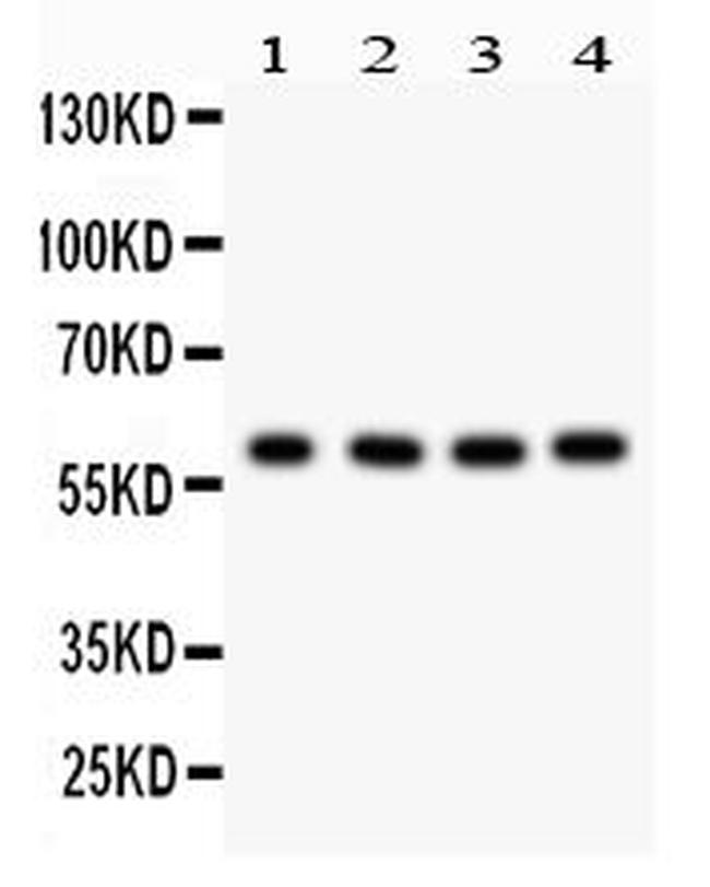 Cdc73 Antibody in Western Blot (WB)