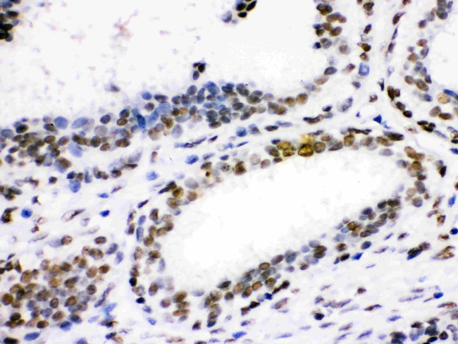 CDK1 Antibody in Immunohistochemistry (Paraffin) (IHC (P))