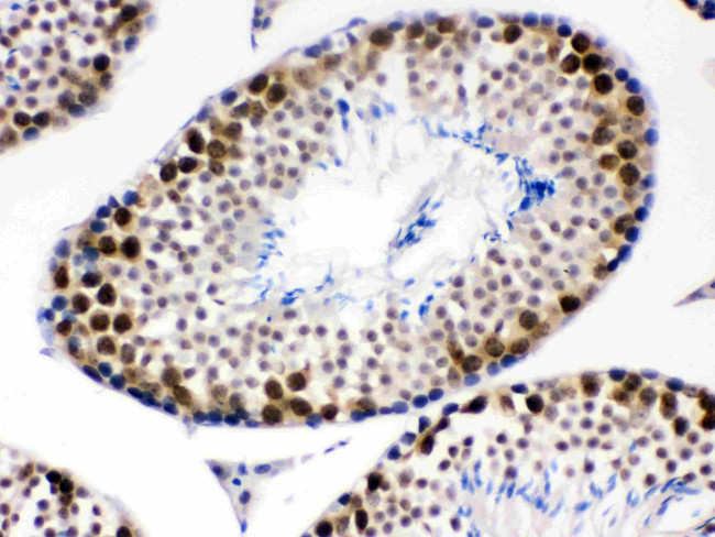 CDK1 Antibody in Immunohistochemistry (Paraffin) (IHC (P))