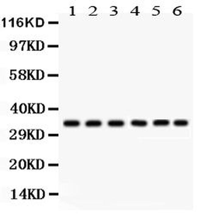 CDK1 Antibody in Western Blot (WB)