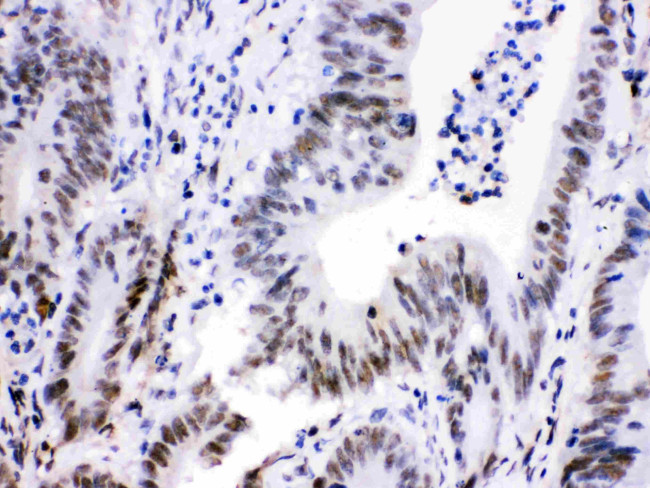 CDK9 Antibody in Immunohistochemistry (Paraffin) (IHC (P))