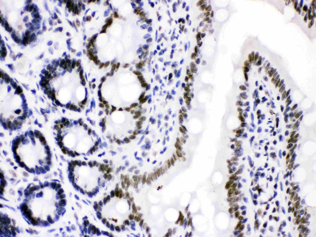 CDK9 Antibody in Immunohistochemistry (Paraffin) (IHC (P))