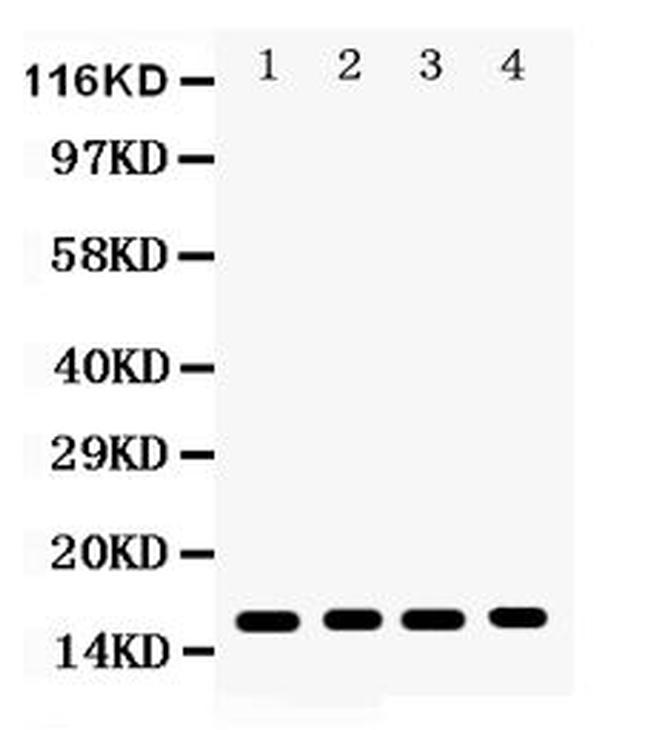 CENPA Antibody in Western Blot (WB)