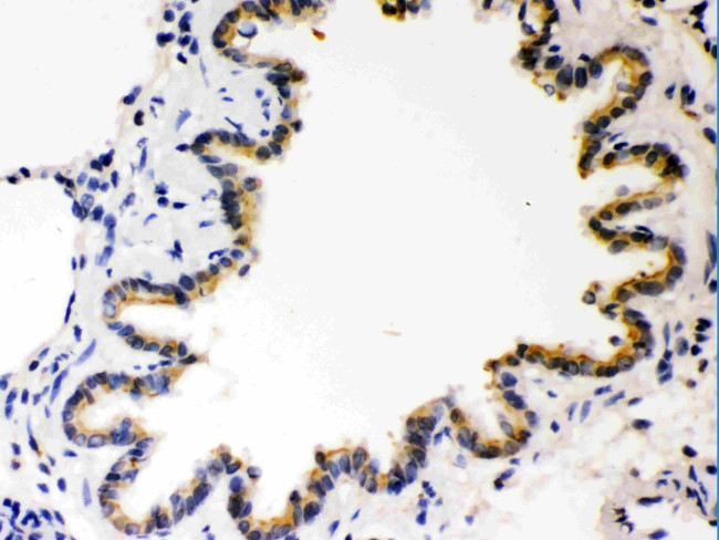 COMT Antibody in Immunohistochemistry (Paraffin) (IHC (P))