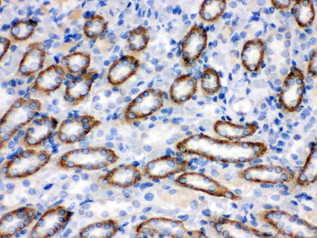 CYP1B1 Antibody in Immunohistochemistry (Paraffin) (IHC (P))