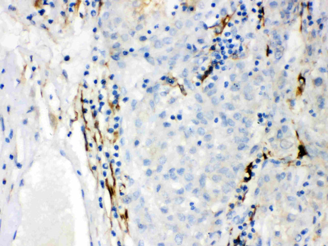 CYP1B1 Antibody in Immunohistochemistry (Paraffin) (IHC (P))