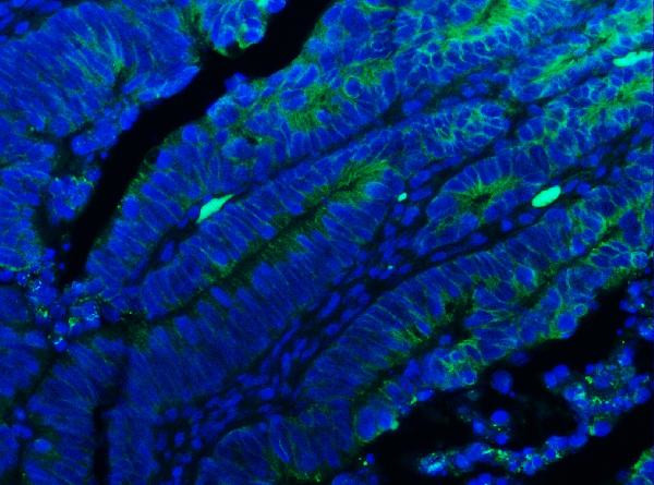 E-cadherin Antibody in Immunohistochemistry (IHC)