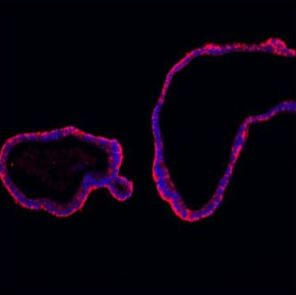 E-cadherin Antibody in Immunohistochemistry (Paraffin) (IHC (P))