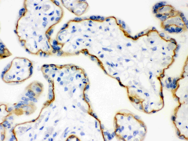 E-cadherin Antibody in Immunohistochemistry (IHC)