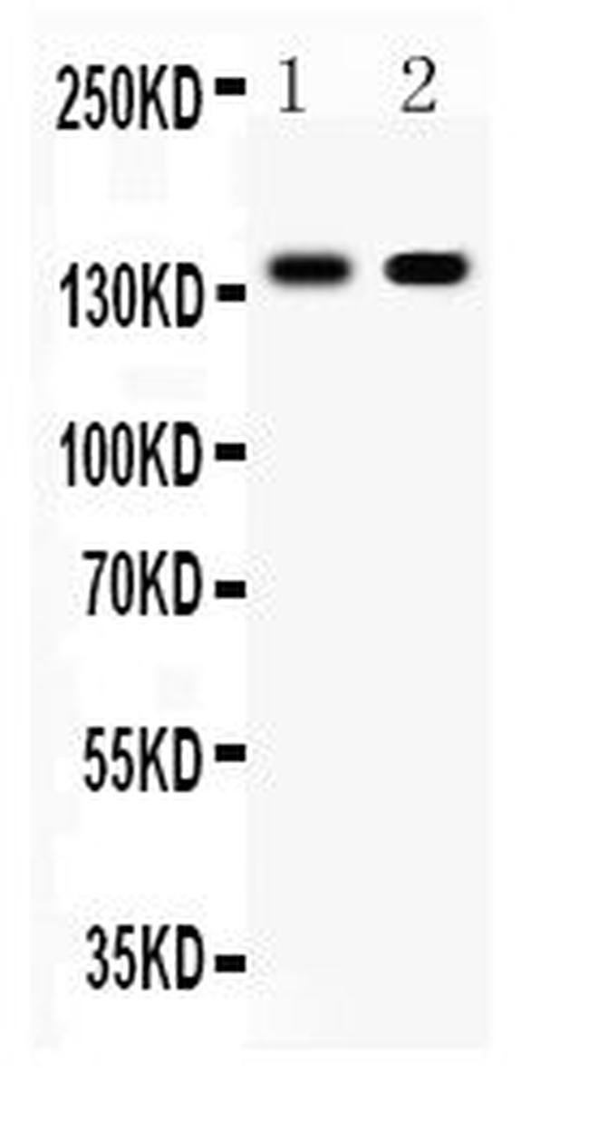 E-cadherin Antibody in Western Blot (WB)