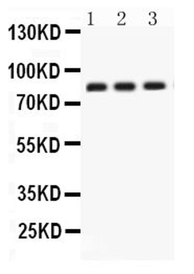 Apolipoprotein J Antibody in Western Blot (WB)