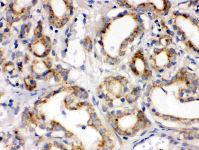 FZD1 Antibody in Immunohistochemistry (Paraffin) (IHC (P))