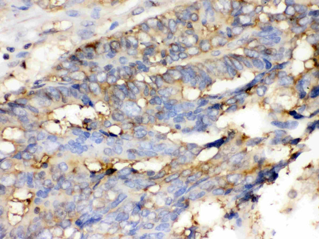 Cofilin Antibody in Immunohistochemistry (Paraffin) (IHC (P))