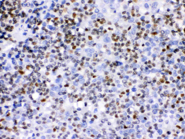 IKAROS Antibody in Immunohistochemistry (Paraffin) (IHC (P))