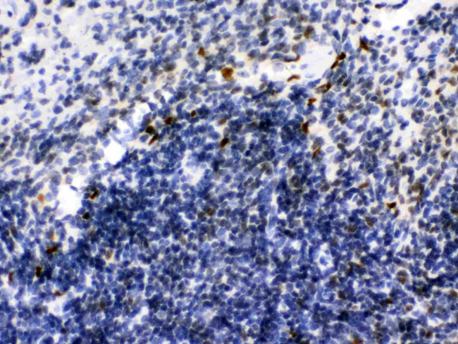 IKAROS Antibody in Immunohistochemistry (Paraffin) (IHC (P))