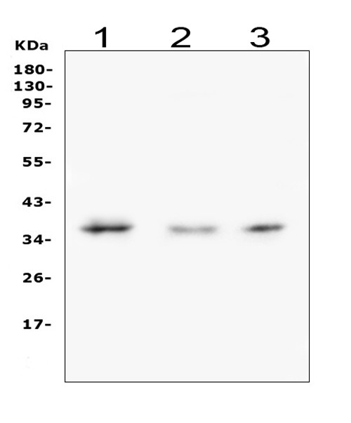 Galectin 8 Antibody in Western Blot (WB)