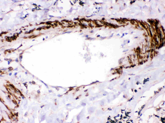 SHP2 Antibody in Immunohistochemistry (Paraffin) (IHC (P))