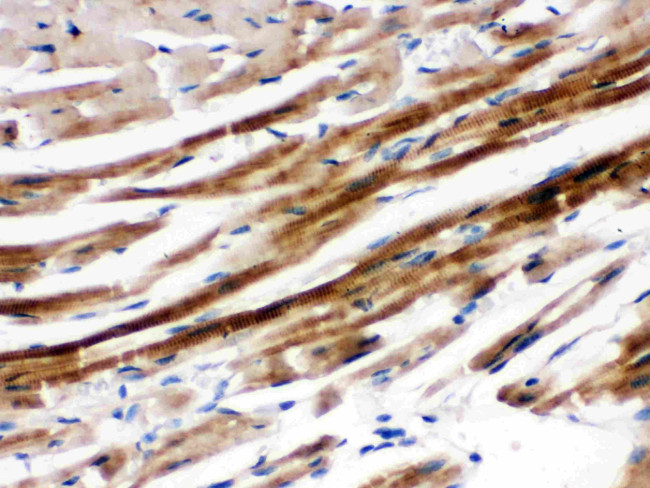 SHP2 Antibody in Immunohistochemistry (Paraffin) (IHC (P))