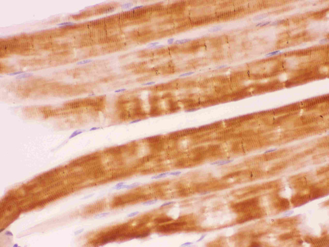 SHP2 Antibody in Immunohistochemistry (Paraffin) (IHC (P))