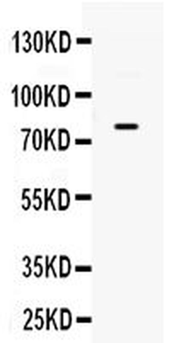 GRK3 Antibody in Western Blot (WB)