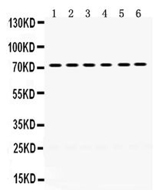 LIMK2 Antibody in Western Blot (WB)