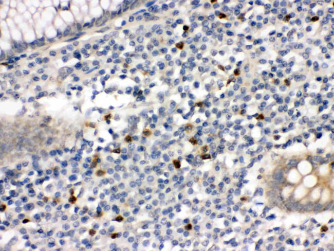 MMP8 Antibody in Immunohistochemistry (Paraffin) (IHC (P))