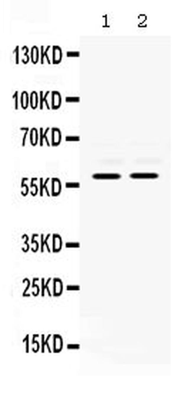 MMP8 Antibody in Western Blot (WB)