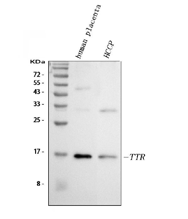 Transthyretin Antibody in Western Blot (WB)