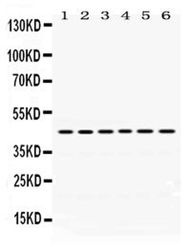 Arg3.1 Antibody in Western Blot (WB)