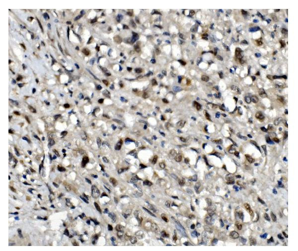 OGT Antibody in Immunohistochemistry (Paraffin) (IHC (P))