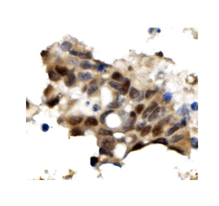 OGT Antibody in Immunohistochemistry (Paraffin) (IHC (P))