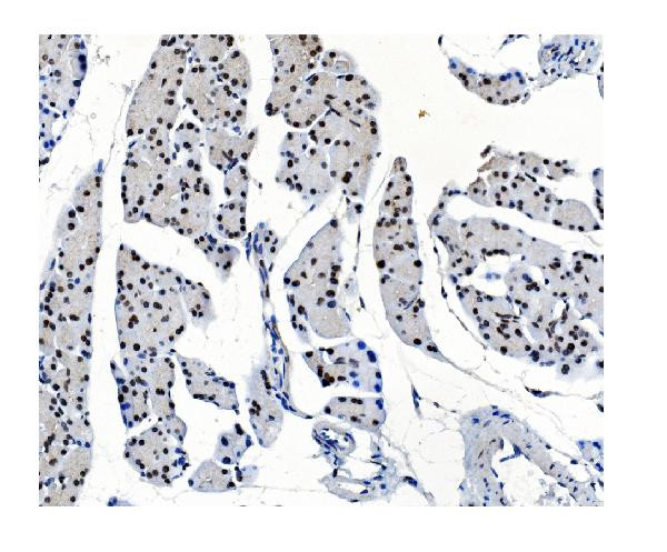 OGT Antibody in Immunohistochemistry (Paraffin) (IHC (P))