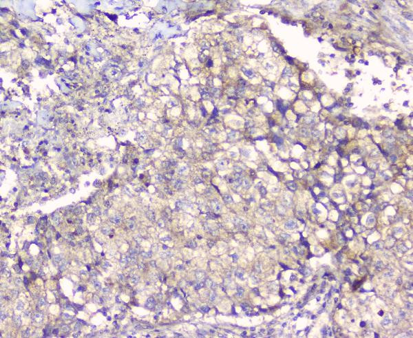 Alix Antibody in Immunohistochemistry (Paraffin) (IHC (P))