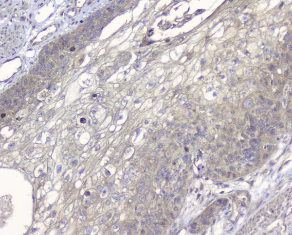 Alix Antibody in Immunohistochemistry (Paraffin) (IHC (P))