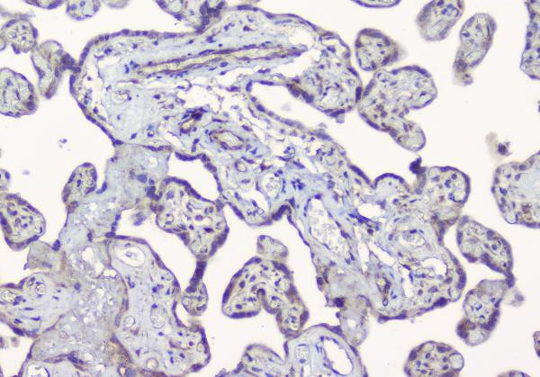 Alix Antibody in Immunohistochemistry (Paraffin) (IHC (P))