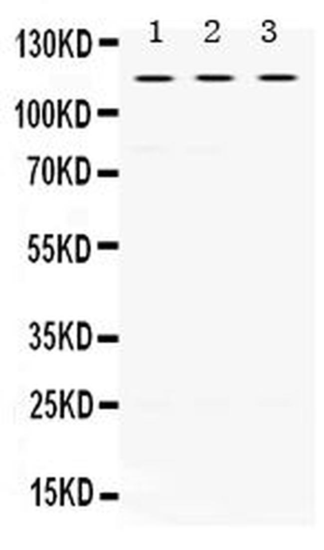 UNC5C Antibody in Western Blot (WB)