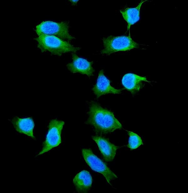 Galectin 1 Antibody in Immunocytochemistry (ICC/IF)