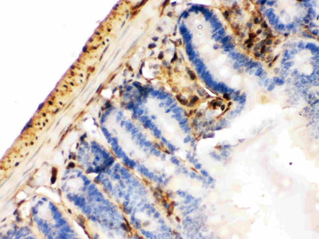 Galectin 1 Antibody in Immunohistochemistry (Paraffin) (IHC (P))