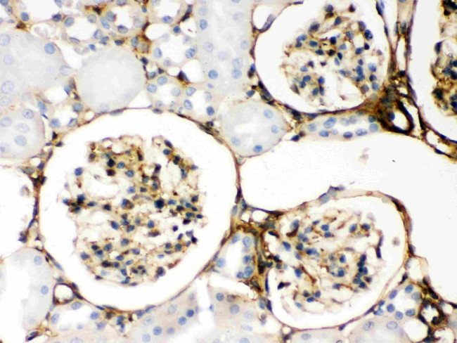 Galectin 1 Antibody in Immunohistochemistry (Paraffin) (IHC (P))