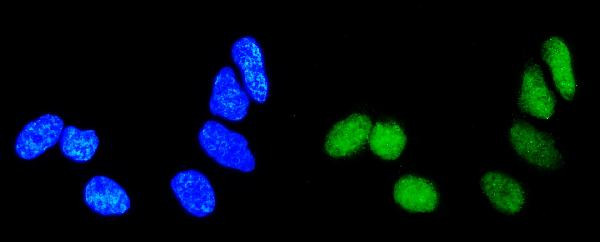 RAB9 Antibody in Immunocytochemistry (ICC/IF)