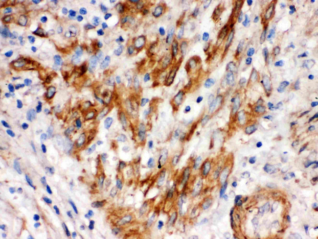 SFRP4 Antibody in Immunohistochemistry (Paraffin) (IHC (P))