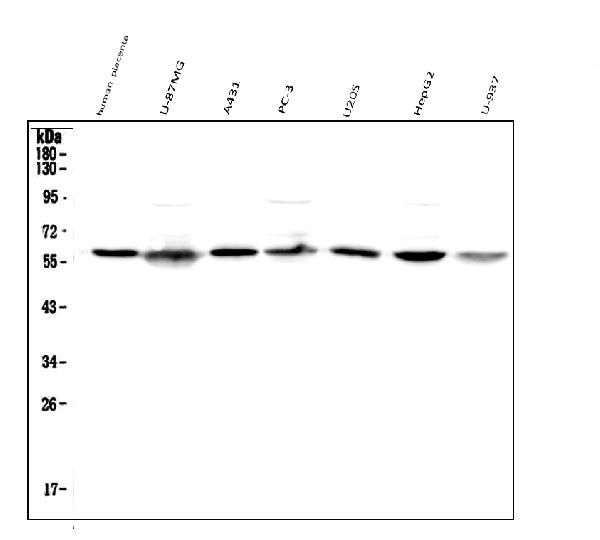 SPTLC1 Antibody in Western Blot (WB)