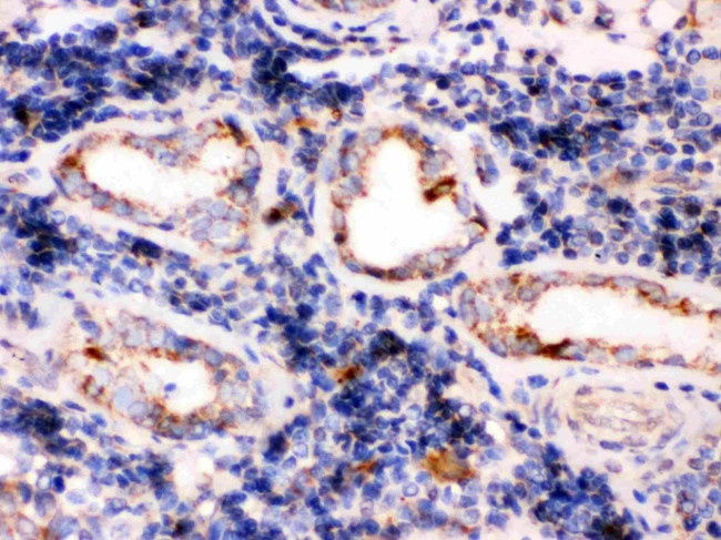 CLN2 Antibody in Immunohistochemistry (Paraffin) (IHC (P))