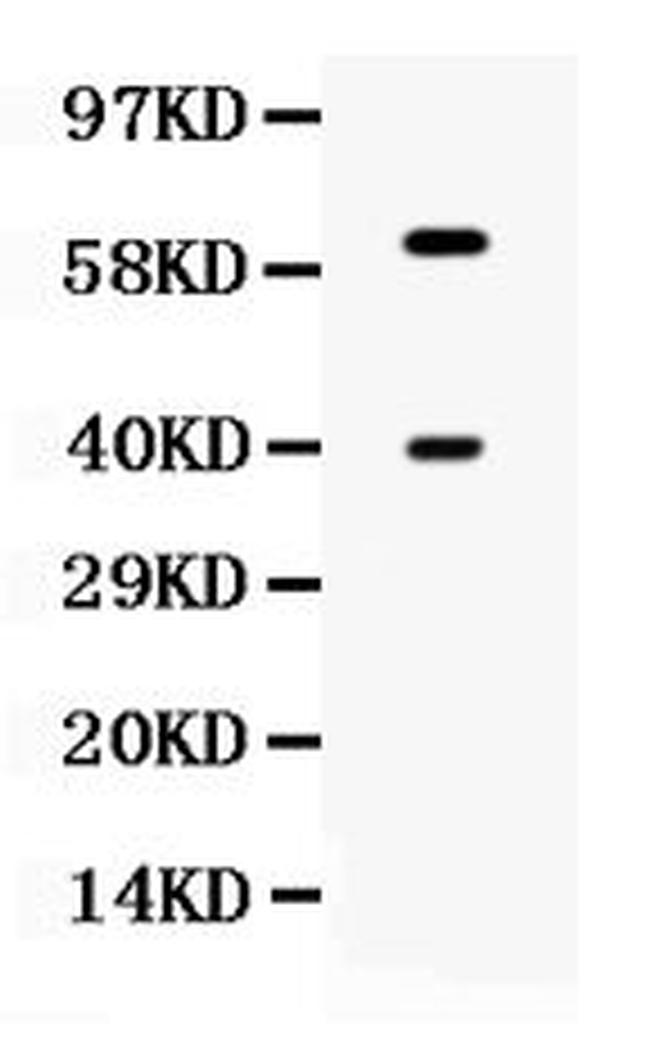 CLN2 Antibody in Western Blot (WB)