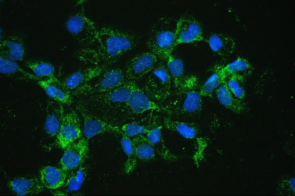 Catalase Antibody in Immunocytochemistry (ICC/IF)