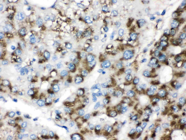 Catalase Antibody in Immunohistochemistry (Paraffin) (IHC (P))