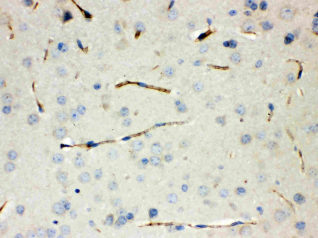 Calcitonin Antibody in Immunohistochemistry (Paraffin) (IHC (P))