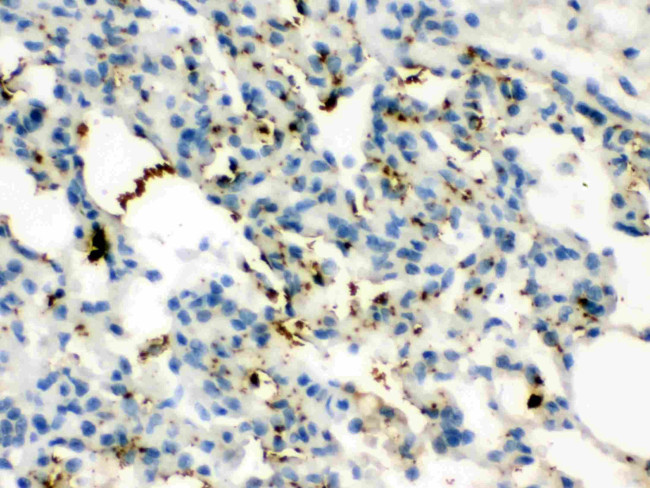 Calcitonin Antibody in Immunohistochemistry (Paraffin) (IHC (P))