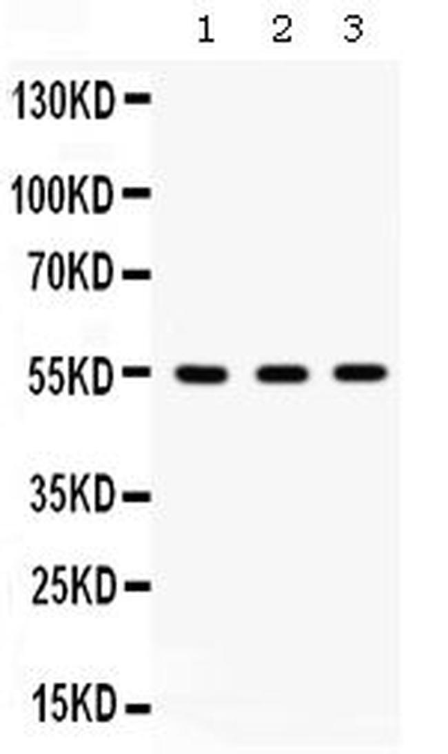 ILK Antibody in Western Blot (WB)